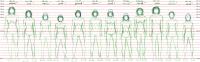 <img200*0:stuff/2007122202_TFK_sexes.jpg>