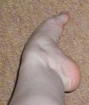 <img0*150:stuff/ArthemisFeet01.jpg>