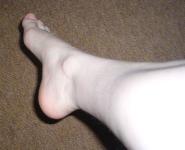 <img0*150:stuff/ArthemisFeet03.jpg>