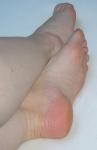 <img0*150:stuff/ArthemisFeet07.jpg>