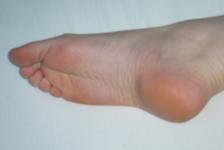 <img0*150:stuff/ArthemisFeet14.jpg>
