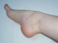 <img0*150:stuff/ArthemisFeet15.jpg>