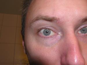<img300*0:stuff/Bored_eye..jpg>