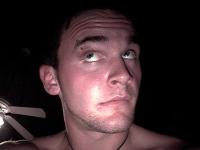 <img200*0:stuff/C%3ADocuments%20and%20SettingsAdministratorMy%20DocumentsImagesMejason%20looking%20at%20bruise.JPG>