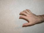 <img150*0:stuff/Claw_hand.jpg>