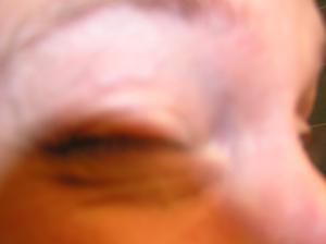 <img300*0:stuff/Closed_eye.jpg>
