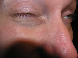 <img300*0:stuff/Closed_eye_with_eyebrow_up.jpg>