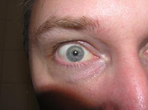 <img300*0:stuff/Crazy_eye.jpg>