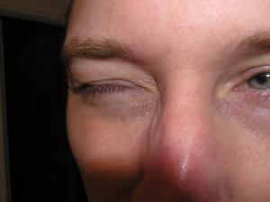 <img300*0:stuff/Eye_closed._.jpg>