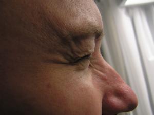 <img300*0:stuff/Eye_closed_from_the_side._.jpg>