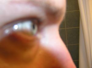 <img300*0:stuff/Eye_from_the_side.jpg>
