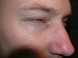 <img300*0:stuff/Eye_half_closed.jpg>