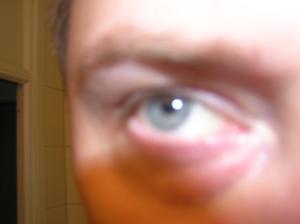 <img300*0:stuff/Eye_in_bad_light.jpg>