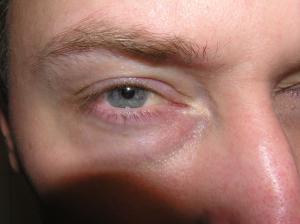 <img300*0:stuff/Eye_looking_at_you._.jpg>