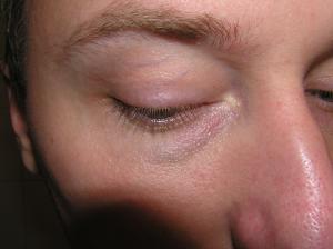 <img300*0:stuff/Eye_looking_down._.jpg>