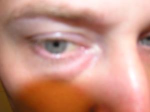 <img300*0:stuff/Eye_looking_down.jpg>