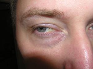 <img300*0:stuff/Eye_looking_left.jpg>