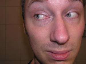 <img300*0:stuff/Eye_looking_right._.jpg>