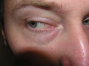 <img300*0:stuff/Eye_looking_to_the_side._.jpg>