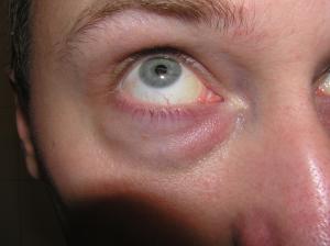 <img300*0:stuff/Eye_looking_up._.jpg>
