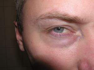 <img300*0:stuff/Eye_normally_looking_at_you.jpg>