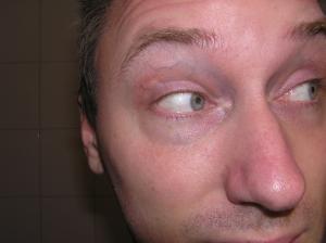 <img300*0:stuff/Eyes_looking_left._.jpg>