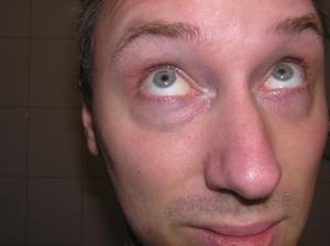 <img300*0:stuff/Eyes_looking_up._.jpg>