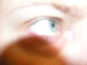 <img300*0:stuff/Flashed_eye.jpg>