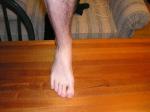 <img150*0:stuff/Foot_from_front.jpg>