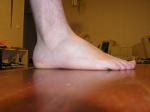 <img150*0:stuff/Foot_from_side.jpg>