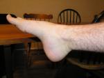 <img150*0:stuff/Foot_pointing.jpg>