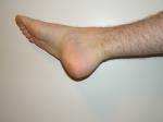 <img150*0:stuff/Foot_pointing_clean_background.jpg>