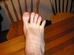 <img150*0:stuff/Foot_spreading_toe.jpg>