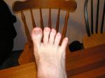 <img150*0:stuff/Foot_spreading_toes..jpg>