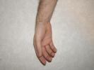 Pictures of a hand