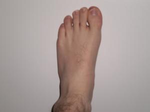 <img300*0:stuff/Left_close_up.jpg>
