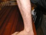 <img150*0:stuff/Lower_hairy_leg.jpg>