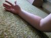 <img100*0:stuff/My_Arm_II.jpg>