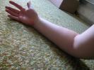 Phoenix Stock ~ Arm reference
