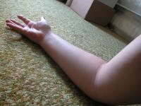 <img200*0:stuff/My_Arm_III.jpg>