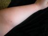 <img100*0:stuff/My_Arm_IV.jpg>