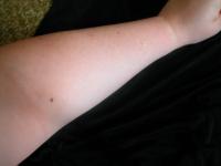 <img200*0:stuff/My_Arm_IV.jpg>