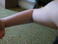 <img200*0:stuff/My_Arm_IX.jpg>