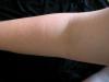 <img100*0:stuff/My_Arm_VI.jpg>
