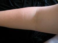 <img200*0:stuff/My_Arm_VI.jpg>