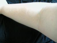 <img200*0:stuff/My_Arm_VII.jpg>