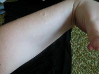 <img200*0:stuff/My_Arm_VIII.jpg>