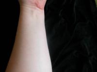 <img200*0:stuff/My_Arm_X.jpg>