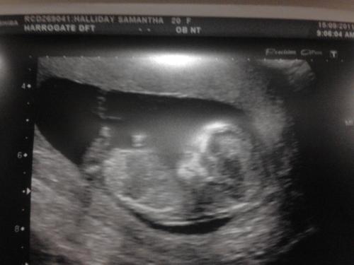 <img500*375:stuff/My_baby_at_12_weeks_x.jpg>