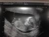 My_baby_at_12_weeks_x